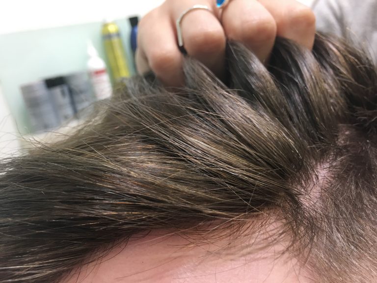 Non-Surgical Hair Integration.