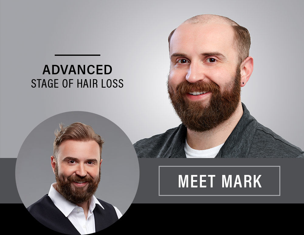 Client Review Hair System Unit