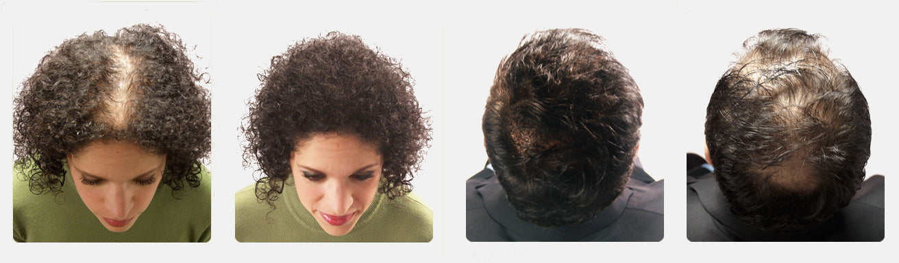 Witness the Magic of Hair Transformation – Real Results with Our Premium Wigs