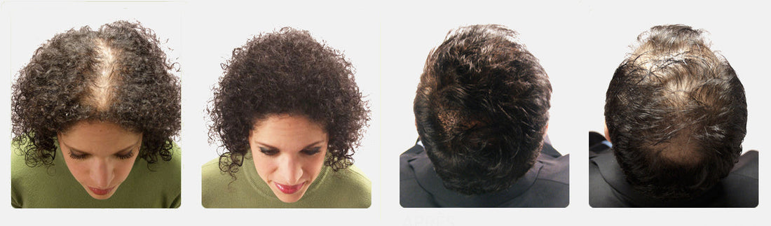 Witness the Magic of Hair Transformation – Real Results with Our Premium Wigs