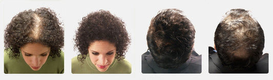 Witness the Magic of Hair Transformation – Real Results with Our Premium Wigs