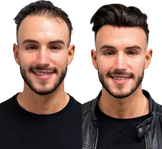 Hair Wigs