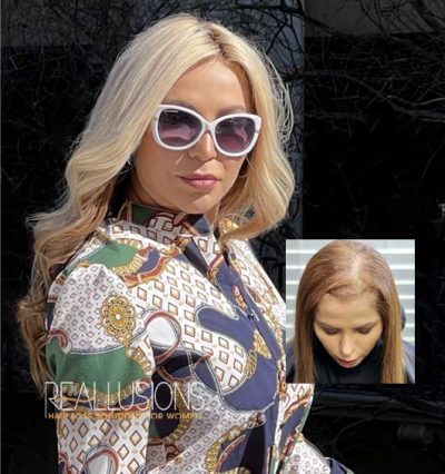 Women Wig